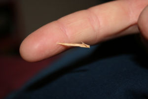 Helps remove a splinter